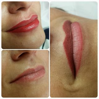 scalp face clinic lips before after